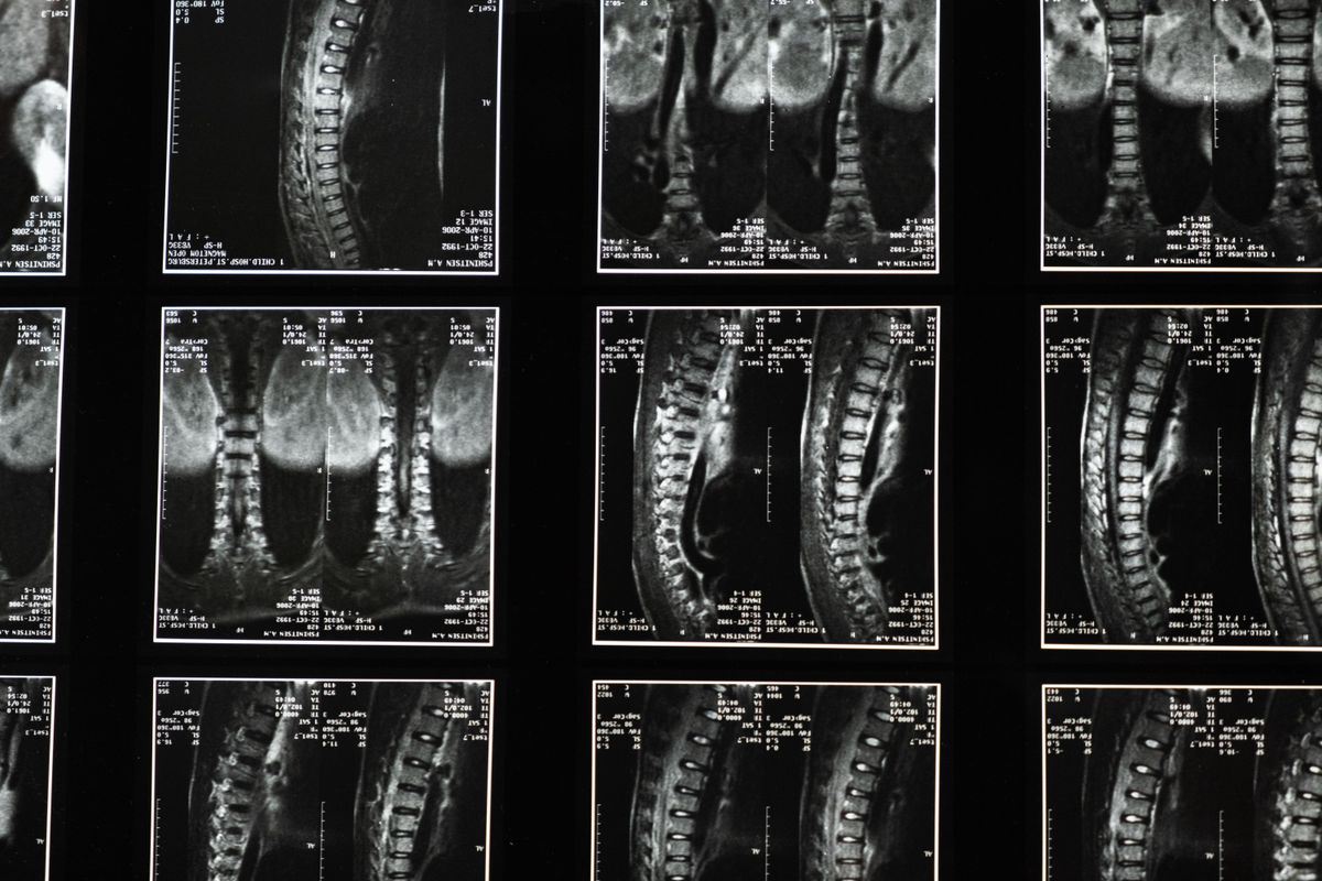 How to Choose a Legal Structure for a New Chiropractic Office