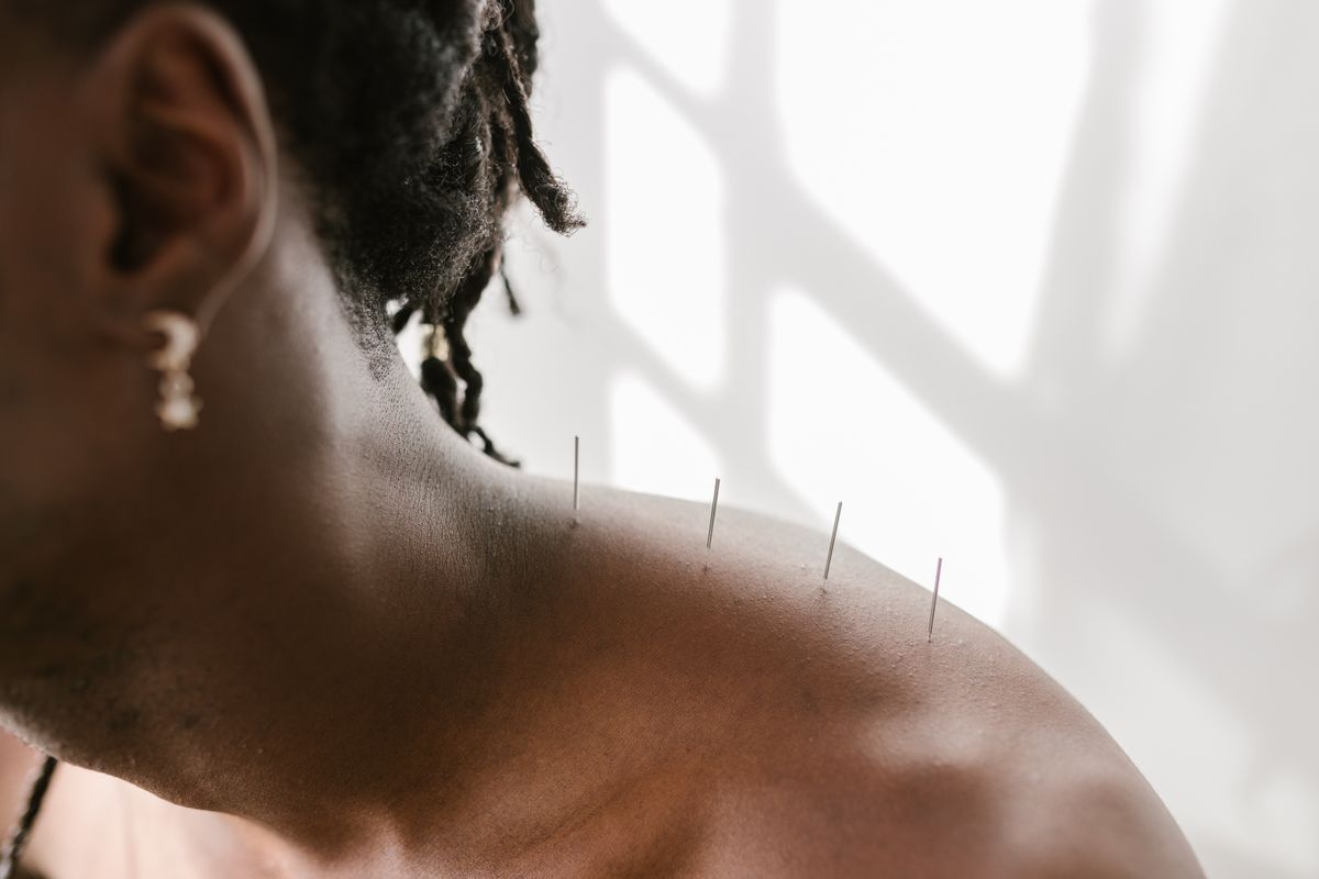 Tax Deductions for New Acupuncture Practices You Are Probably Missing